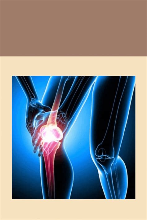 Артроз тазобедренного сустава - причина боли в колене